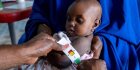 Nigeria : plus de 600 enfants morts de malnutrition ces six derniers mois, alerte Médecins sans frontières