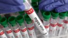 L'Organisation mondiale de la Santé maintient l'alerte face à l'épidémie de mpox