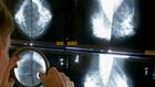Cancer du sein: soutiens gorge, déodorants, comment tirer au clair les fausses idées autour des risques de cancer ?