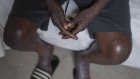 Nouveaux cas et décès : Situation préoccupante avec le Mpox et la fièvre de la Vallée du Rift