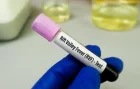Fièvre de la Vallée du Rift et Mpox : Après Dakar, une autre région impactée
