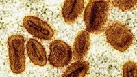 Le Ghana connaît sa plus forte épidémie de mpox depuis 2022