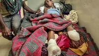 Guerre en Ethiopie: dans un hôpital de Mekele, au Tigré, des enfants amputés, la douleur partout