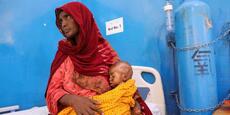 En Somalie, la moitié des enfants déplacés dans les camps du sud-ouest souffrent de malnutrition aiguë