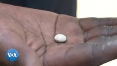 Les calculs rénaux en hausse en Afrique
