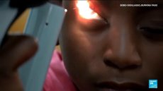 Portrait de l'unique ophtalmologue pour enfants du Burkina Faso
