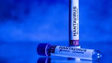 Hantavirus: isolement à domicile recommandé pour les contacts proches du touriste franco-argentin
