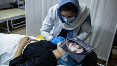 Greffe de barbe, botox sous burqa: à Kaboul, la chirurgie esthétique en vogue