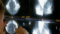 Cancer du sein: soutiens gorge, déodorants, comment tirer au clair les fausses idées autour des risques de cancer ?