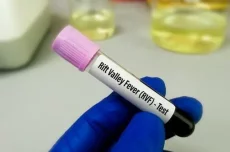 Alerte rouge : 363 cas et 29 décès de Fièvre de la Vallée du Rift recensés